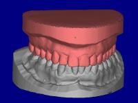 CAD 3D model from optical scanenr of dental arch