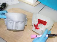Maxillo-facial model from a TAC