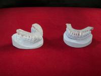 Mold and prototypes in stereolitography of dental archs
